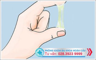 Ra khí hư màu vàng dấu hiệu bệnh phụ khoa cần điều trị ngay