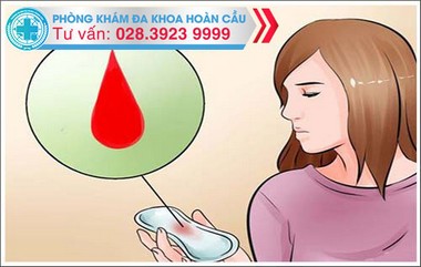 Tổng quan về xuất huyết tử cung bất thường
