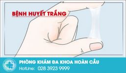 Tiêu đề không dấu