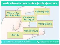 Tiêu đề không dấu