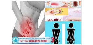 Polyp cổ tử cung và nguyên nhân hình thành bệnh