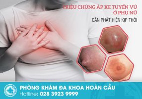 Bệnh áp xe tuyến vú ở phụ nữ và cách điều trị hiệu quả