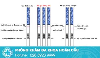 Cách dùng que thử thai đúng cách - bạn đã biết chưa?