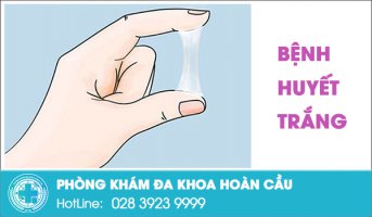 Bị huyết trắng làm sao hết?