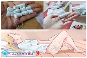 Kén đặt phụ khoa có tốt không? sử dụng như thế nào?