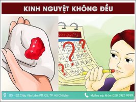 Kinh nguyệt không đều và cách điều kinh hiệu quả nhất