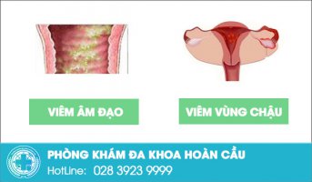 Quan hệ bị thốn nói lên điều gì?