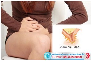 Cẩn trọng chứng đi tiểu buốt ở nữ giới