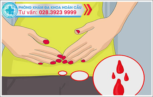 Tình trạng xuất huyết âm đạo bất thường ở nữ giới