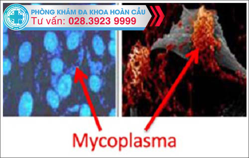 Triệu chứng bệnh Mycoplasma